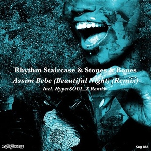 Rhythm Staircase, Stones & Bones - Assim Bebe (Beautiful Night) [Remix] [KNG865]