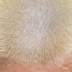 Barnt - You Know What's Gone [KOMPAKT4421]